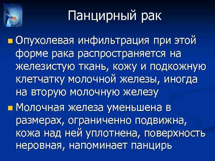 Панцирный рак n Опухолевая инфильтрация при этой форме рака распространяется на железистую ткань, кожу