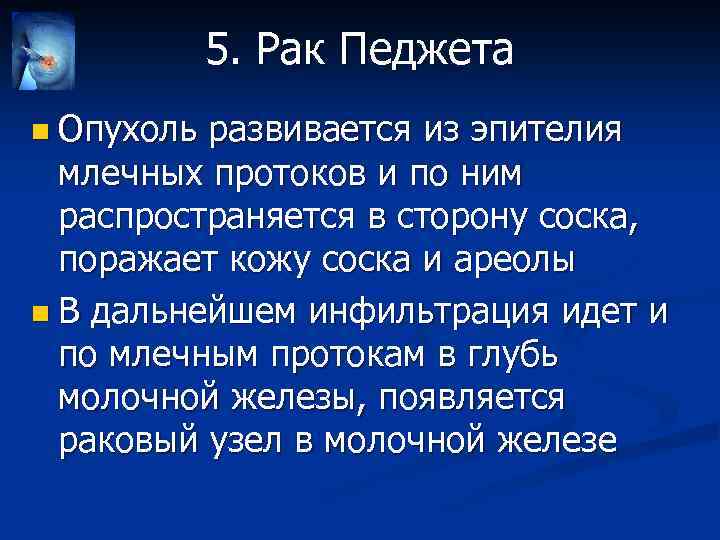 5. Рак Педжета n Опухоль развивается из эпителия млечных протоков и по ним распространяется