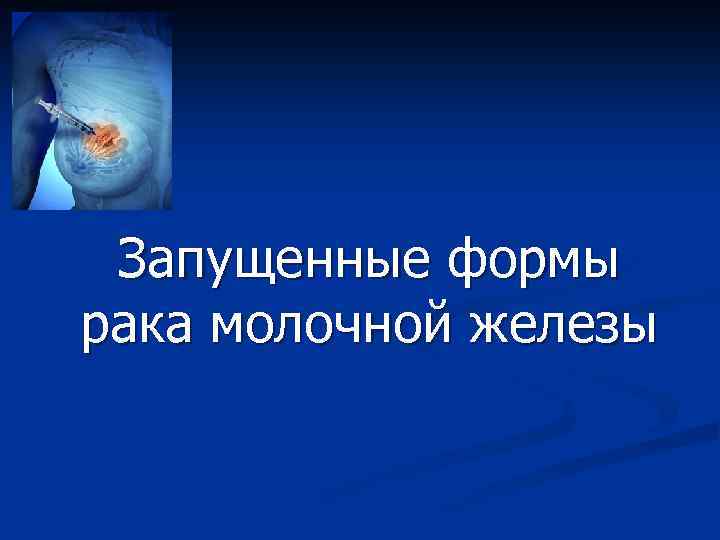 Запущенные формы рака молочной железы 