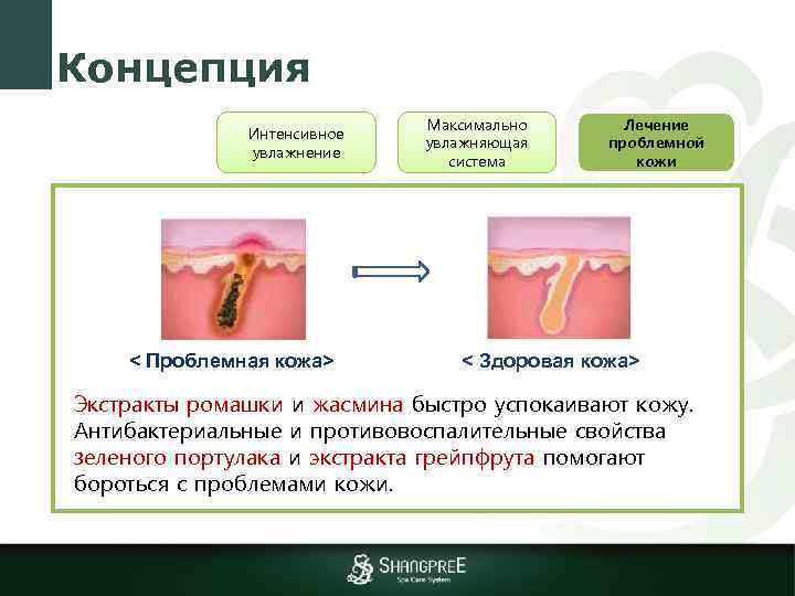 Концепция Интенсивное увлажнение < Проблемная кожа> Максимально увлажняющая система Лечение проблемной кожи < Здоровая