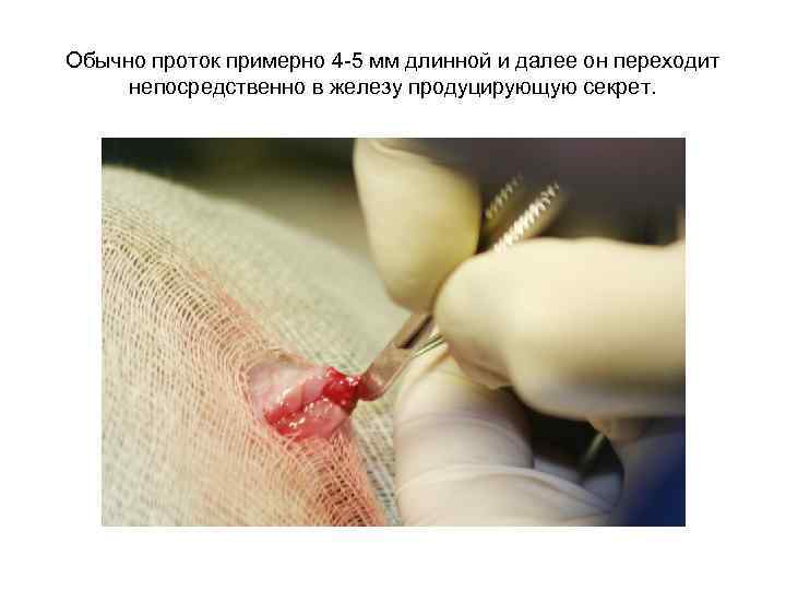 Обычно проток примерно 4 -5 мм длинной и далее он переходит непосредственно в железу