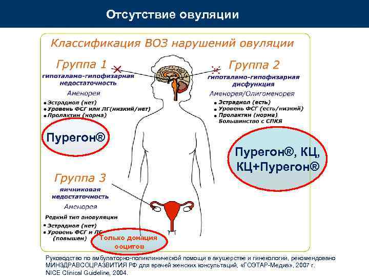 Отсутствие овуляции Пурегон®, КЦ+Пурегон® Только донация ооцитов Руководство по амбулаторно-поликлинической помощи в акушерстве и