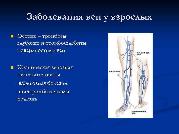 Заболевания вен у взрослых n n Острые – тромбозы глубоких и тромбофлебиты поверхностных вен