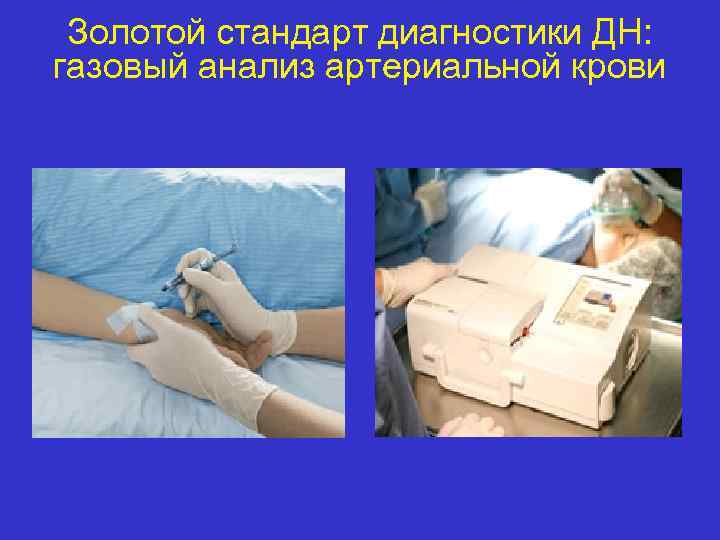 Золотой стандарт диагностики ДН: газовый анализ артериальной крови 