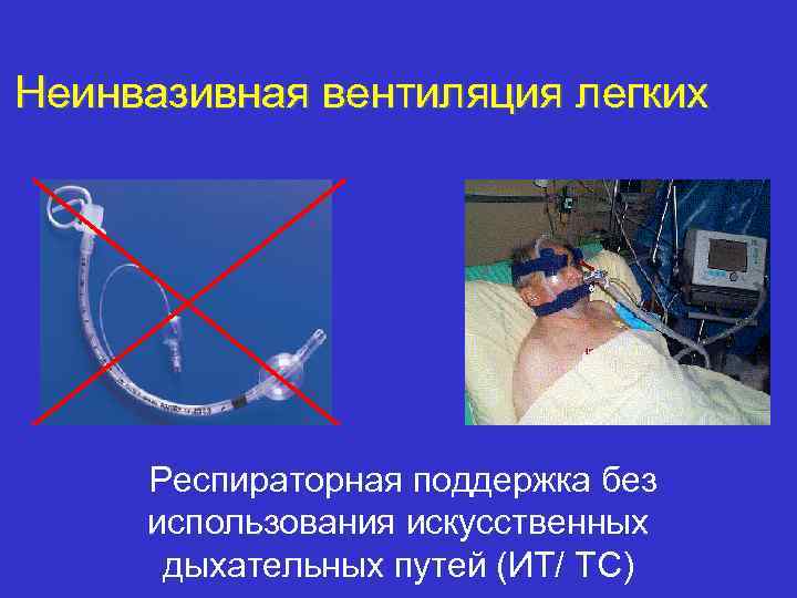 Неинвазивная вентиляция легких Респираторная поддержка без использования искусственных дыхательных путей (ИТ/ ТС) 