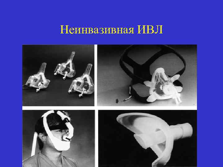 Неинвазивная ИВЛ 