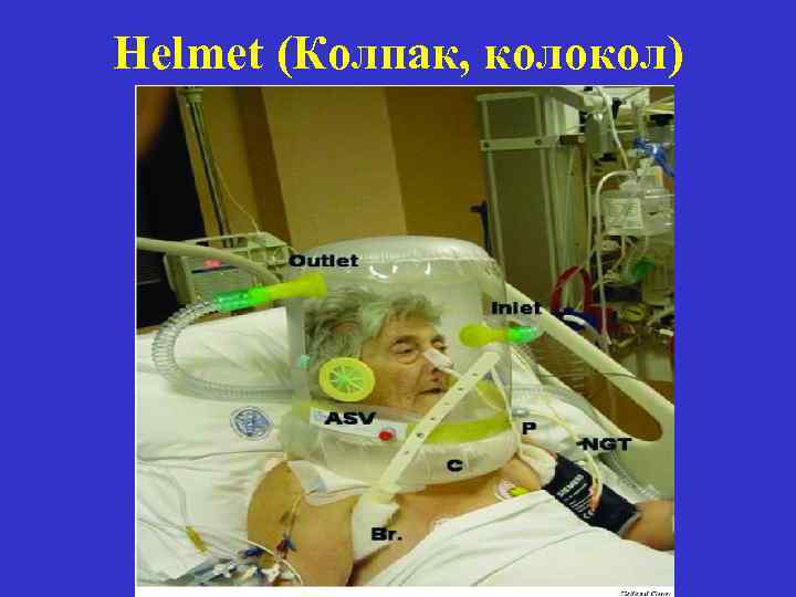 Helmet (Колпак, колокол) 