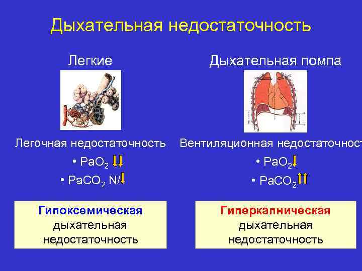 Обусловлено дыхательной недостаточностью. Патогенез вентиляционной дыхательной недостаточности. Типы острой дыхательной недостаточности. Паренхиматозная дыхательная недостаточность. Гипоксемический Тип дыхательной недостаточности.