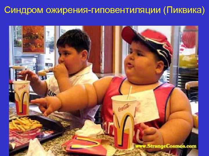 Синдром ожирения-гиповентиляции (Пиквика) 