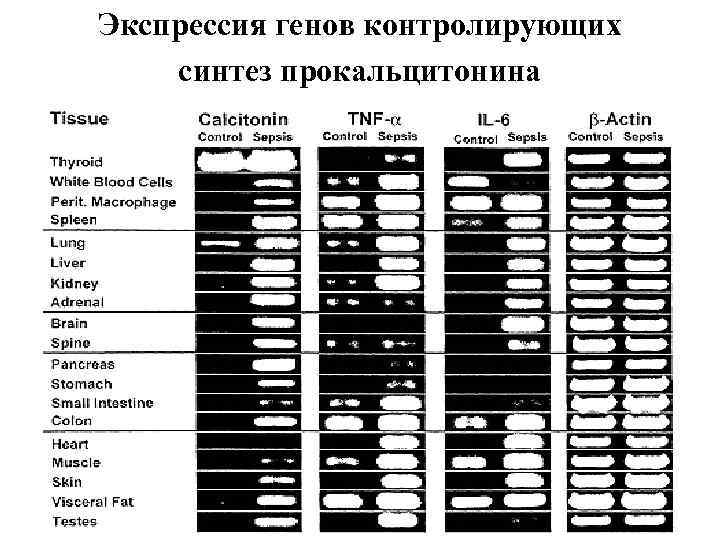 Экспрессия генов контролирующих синтез прокальцитонина 