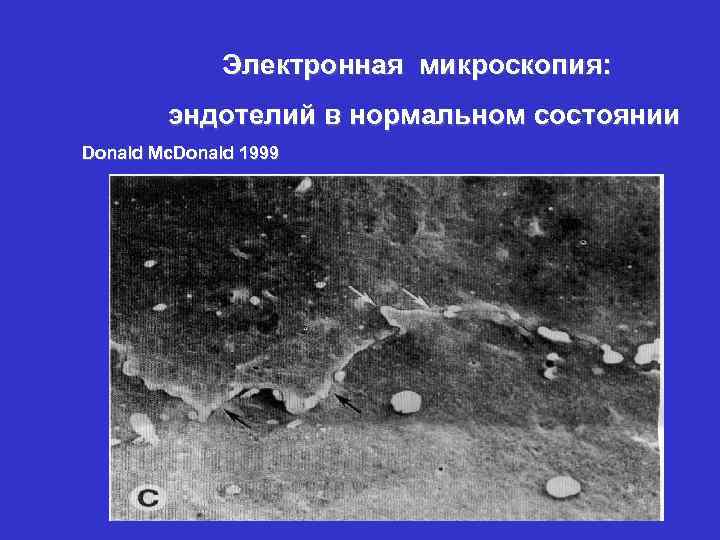 Электронная микроскопия: эндотелий в нормальном состоянии Donald Mc. Donald 1999 