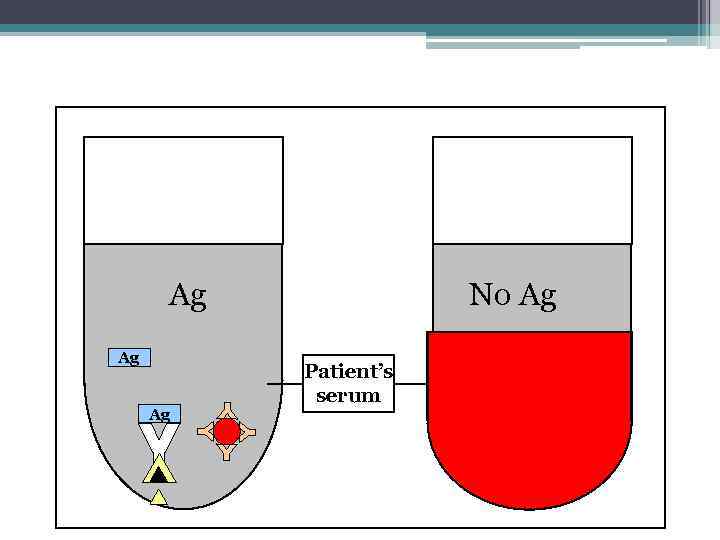 No Ag Ag Patient’s serum 