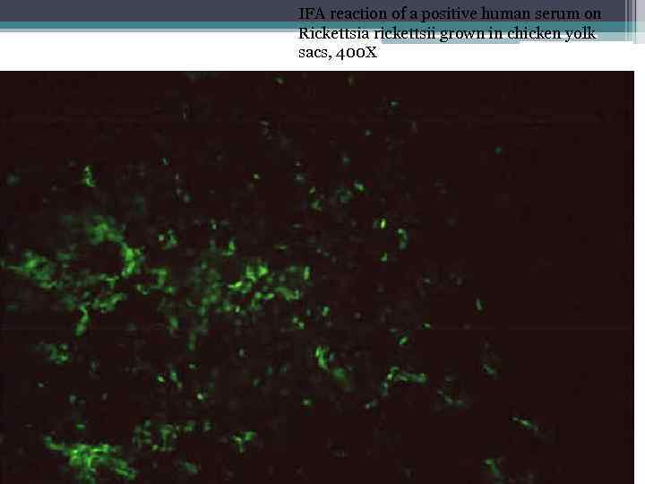 IFA reaction of a positive human serum on Rickettsia rickettsii grown in chicken yolk