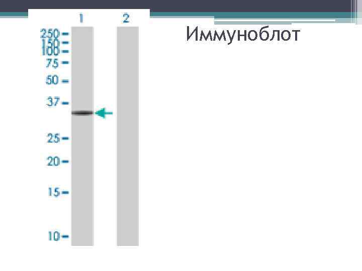 Иммуноблот 