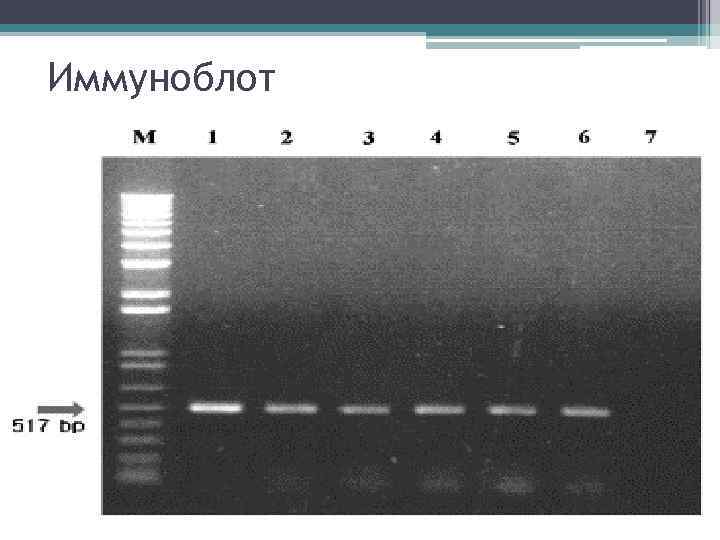 Иммуноблот 
