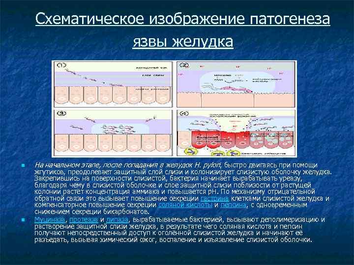 Схематическое изображение патогенеза язвы желудка n n На начальном этапе, после попадания в желудок