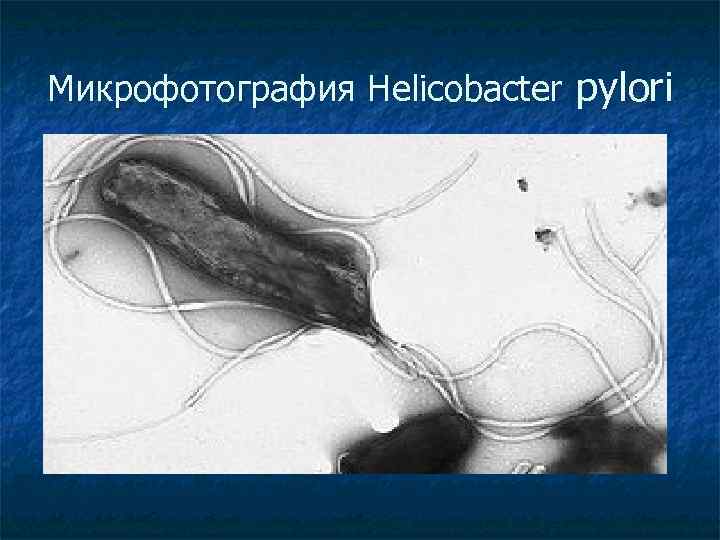 Микрофотография Helicobacter pylori 