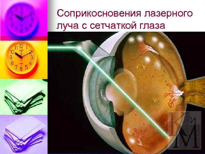Соприкосновения лазерного луча с сетчаткой глаза 