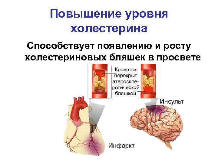 Повышение уровня холестерина Способствует появлению и росту холестериновых бляшек в просвете сосуда. 