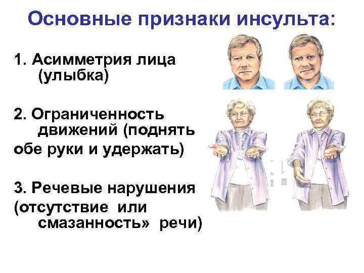 Микроинсульт речи