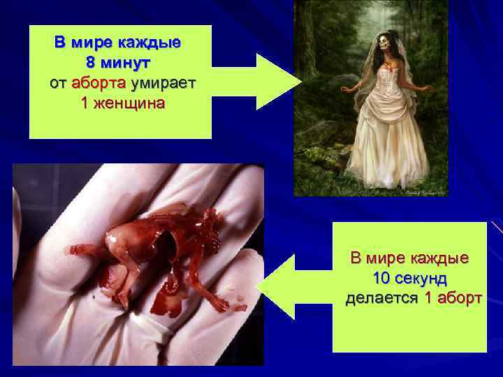 В мире каждые 8 минут от аборта умирает 1 женщина В мире каждые 10