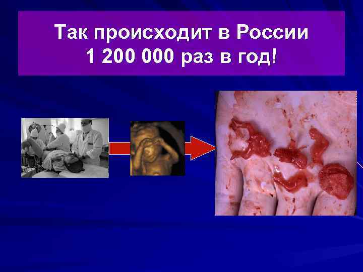 Так происходит в России 1 200 000 раз в год! 