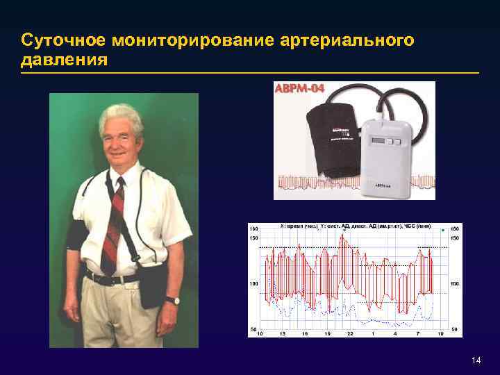 Суточное мониторирование артериального давления 14 