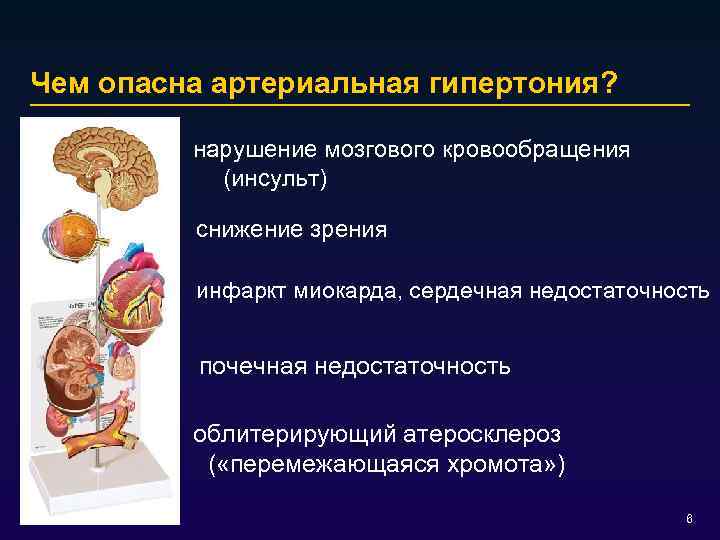 Чем опасна артериальная гипертония? нарушение мозгового кровообращения (инсульт) снижение зрения инфаркт миокарда, сердечная недостаточность