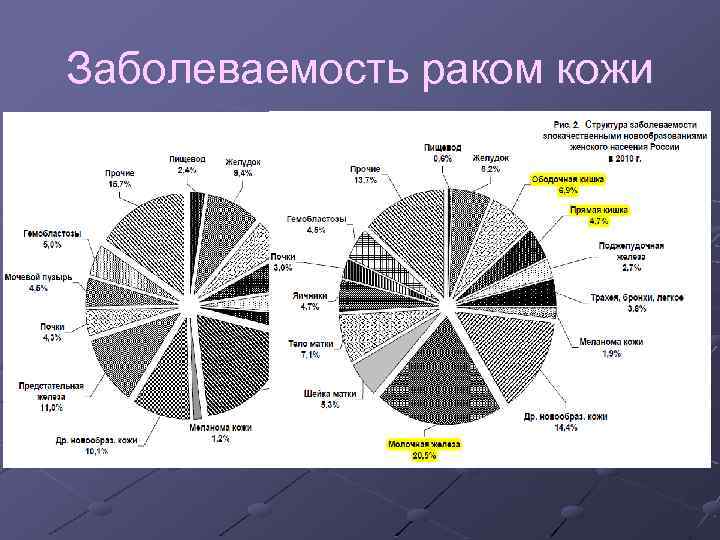 Заболеваемость раком кожи 