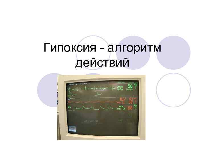 Гипоксия - алгоритм действий 