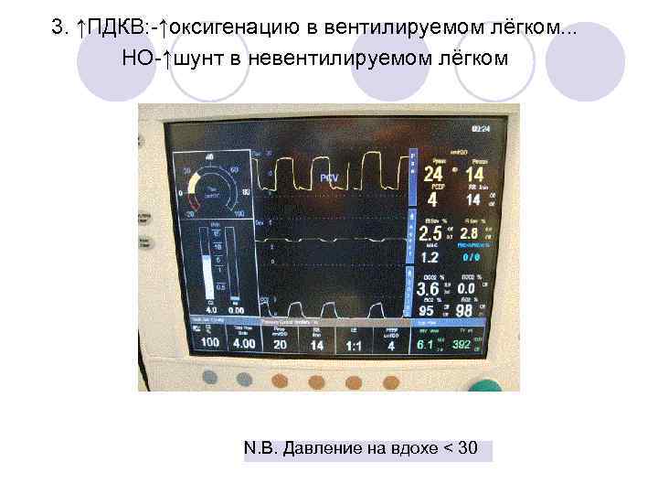 3. ↑ПДКВ: -↑оксигенацию в вентилируемом лёгком. . . НО-↑шунт в невентилируемом лёгком N. B.