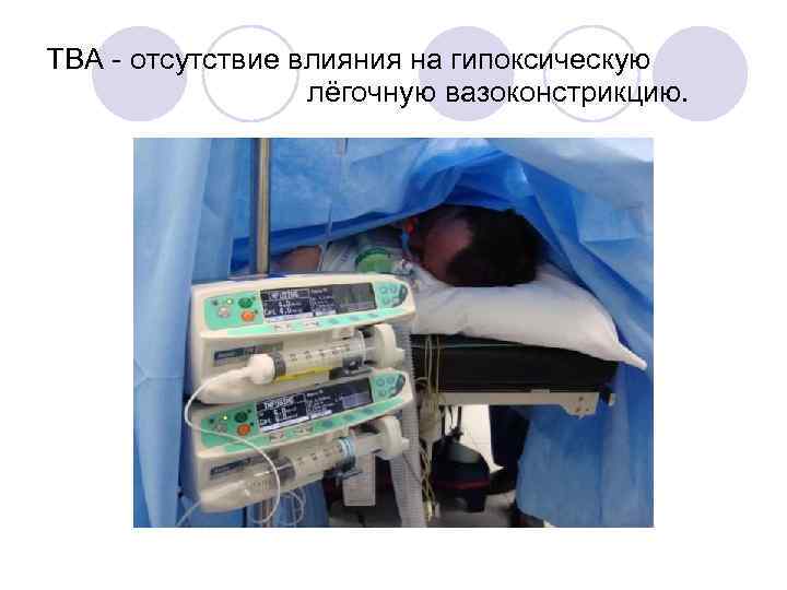 TBA - отсутствие влияния на гипоксическую лёгочную вазоконстрикцию. 