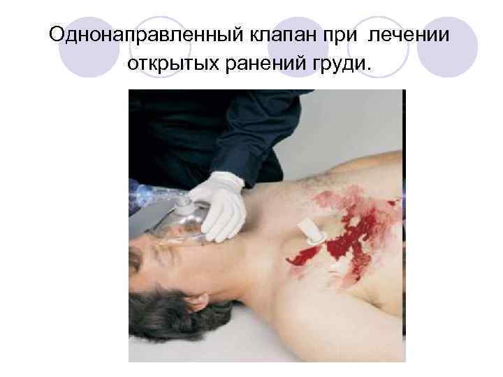 Однонаправленный клапан при лечении открытых ранений груди. 