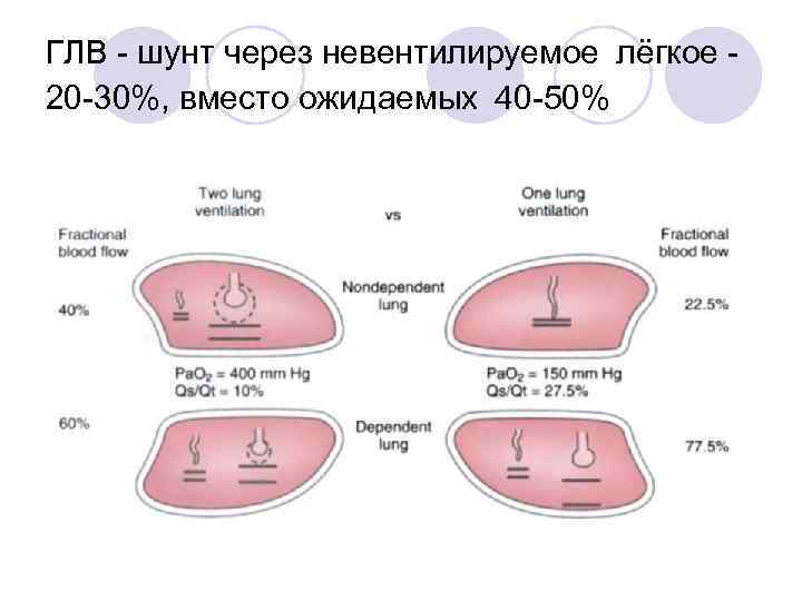 ГЛВ - шунт через невентилируемое лёгкое 20 -30%, вместо ожидаемых  40 -50% 