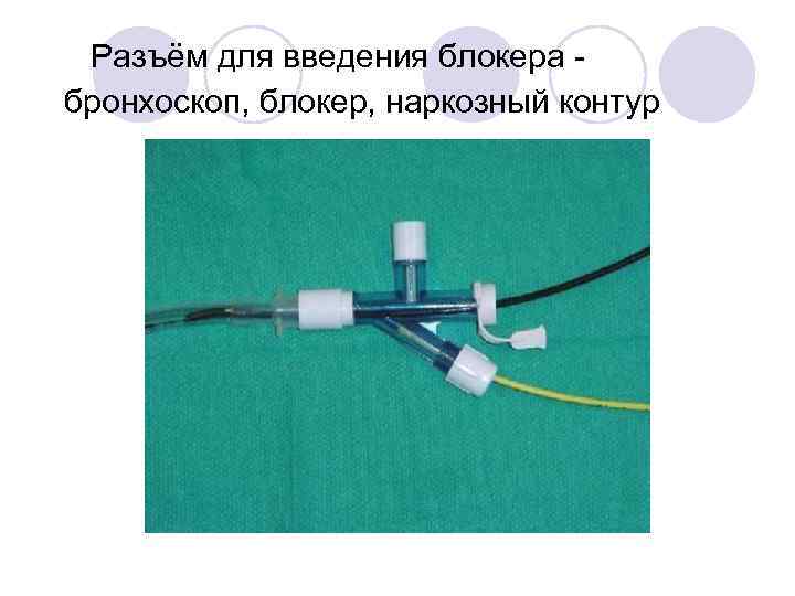 Разъём для введения блокера  бронхоскоп, блокер, наркозный контур 