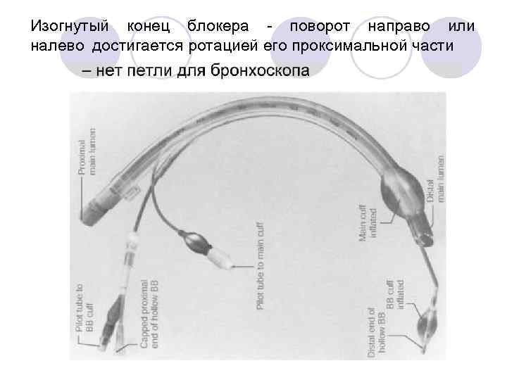 Изогнутый конец блокера - поворот направо или налево достигается ротацией его проксимальной части 