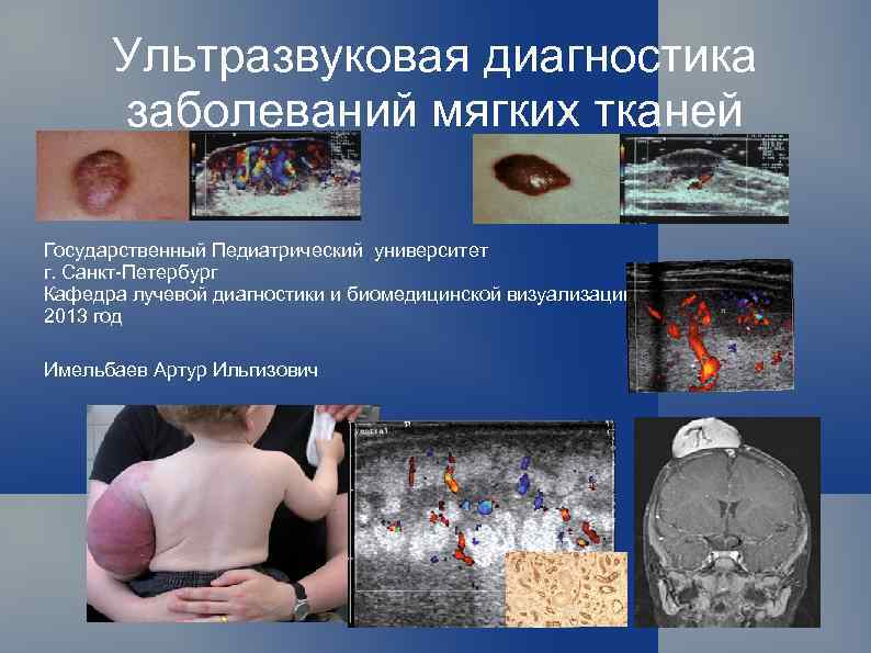 Ультразвуковая диагностика заболеваний мягких тканей Государственный Педиатрический университет г. Санкт-Петербург Кафедра лучевой диагностики и