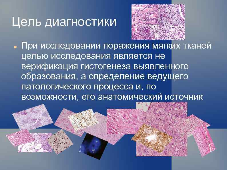 Цель диагностики При исследовании поражения мягких тканей целью исследования является не верификация гистогенеза выявленного