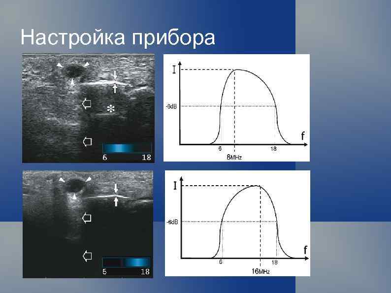 Настройка прибора 