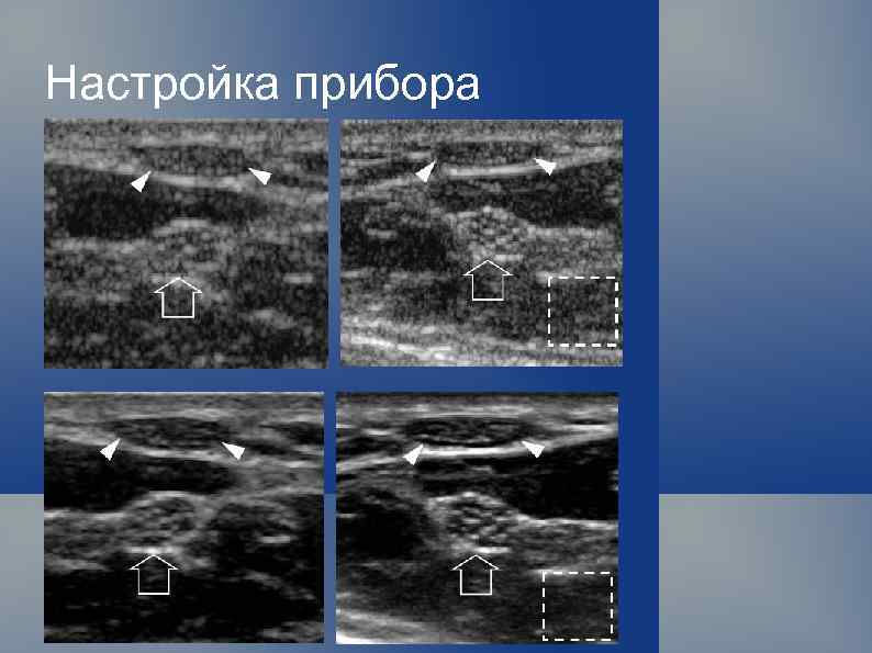 Настройка прибора 