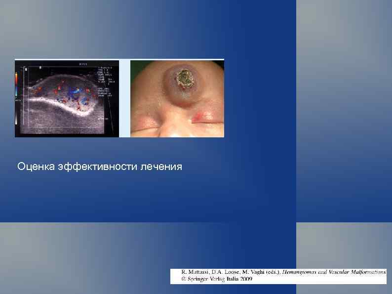 Оценка эффективности лечения 