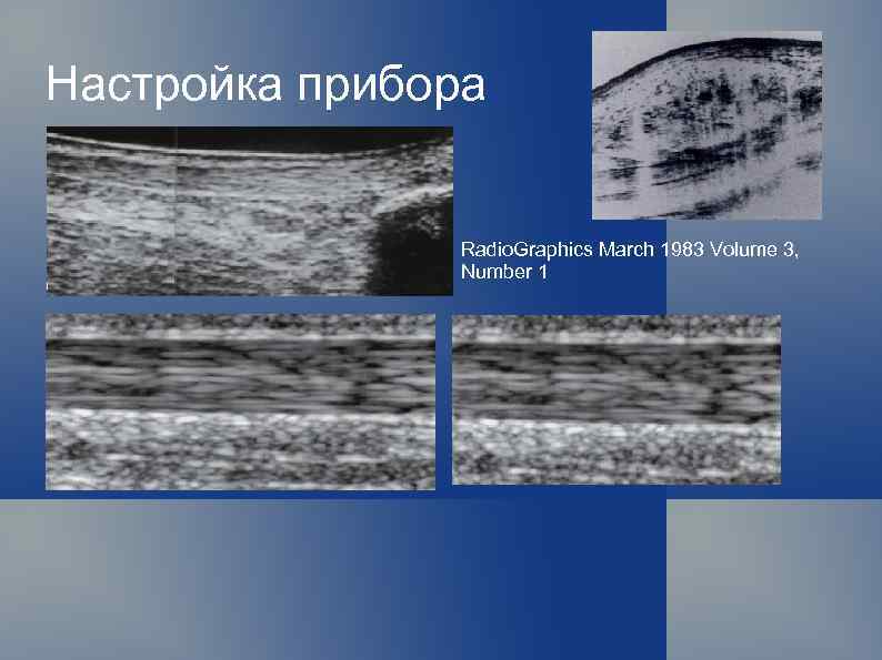 Настройка прибора Radio. Graphics Мarch 1983 Volume 3, Number 1 