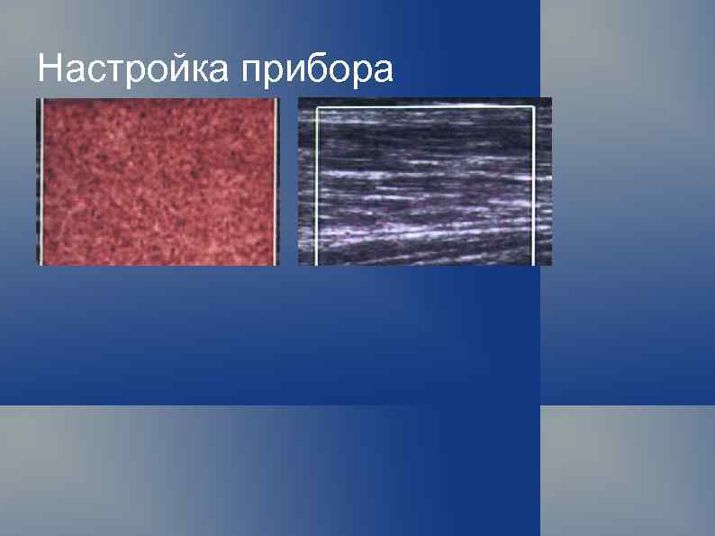 Настройка прибора 