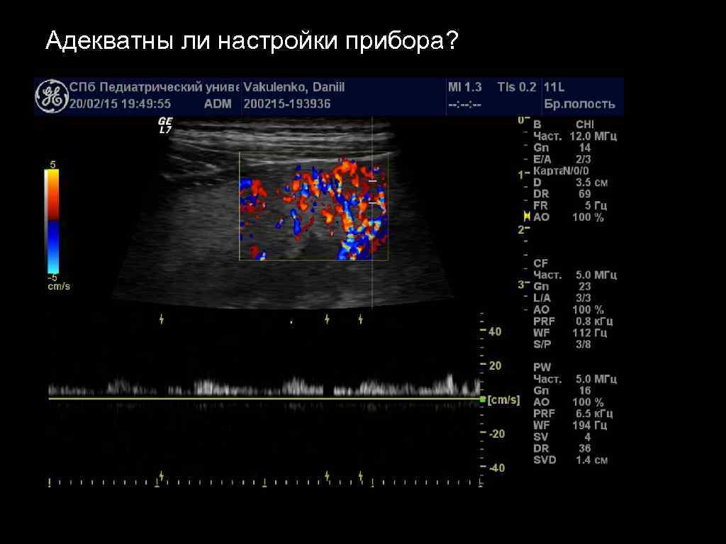 Адекватны ли настройки прибора? 