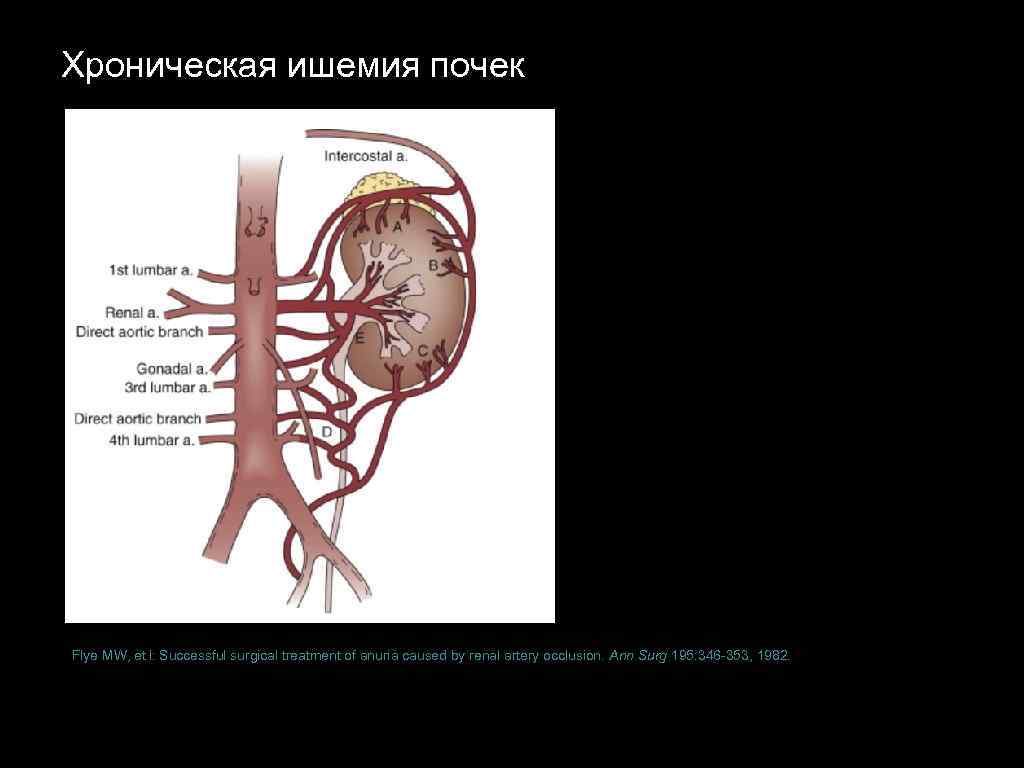 Хроническая ишемия почек Flye MW, et l: Successful surgical treatment of anuria caused by renal