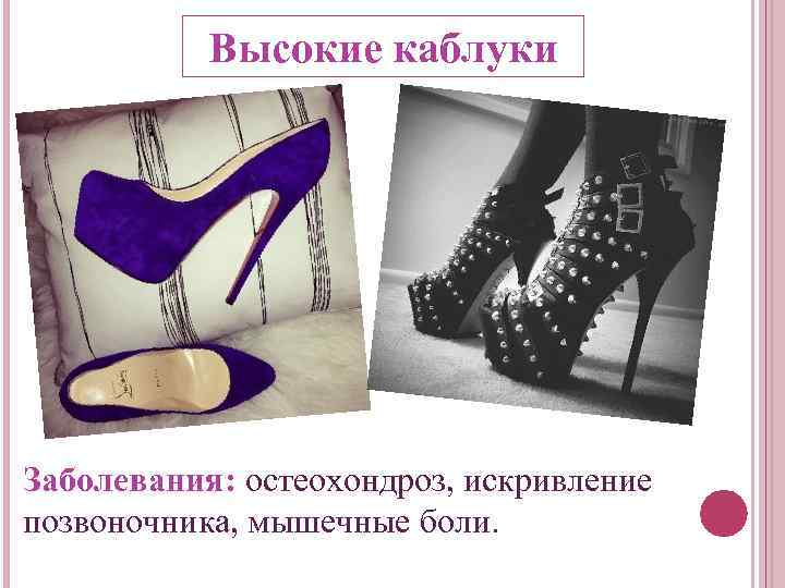 Высокие каблуки Заболевания: остеохондроз, искривление позвоночника, мышечные боли. 