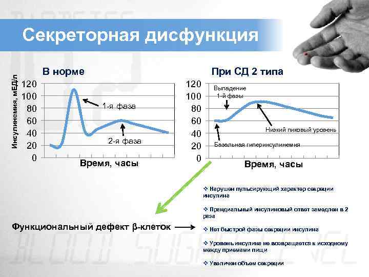 Инсулинемия, м. ЕД/л Секреторная дисфункция При СД 2 типа В норме 120 100 80