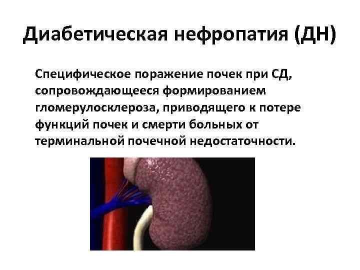 Диабетическая нефропатия картинки