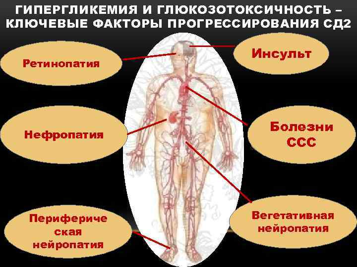 ГИПЕРГЛИКЕМИЯ И ГЛЮКОЗОТОКСИЧНОСТЬ – КЛЮЧЕВЫЕ ФАКТОРЫ ПРОГРЕССИРОВАНИЯ СД 2 Ретинопатия Нефропатия Перифериче ская нейропатия
