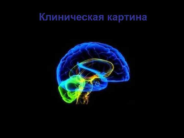 Клиническая картина 